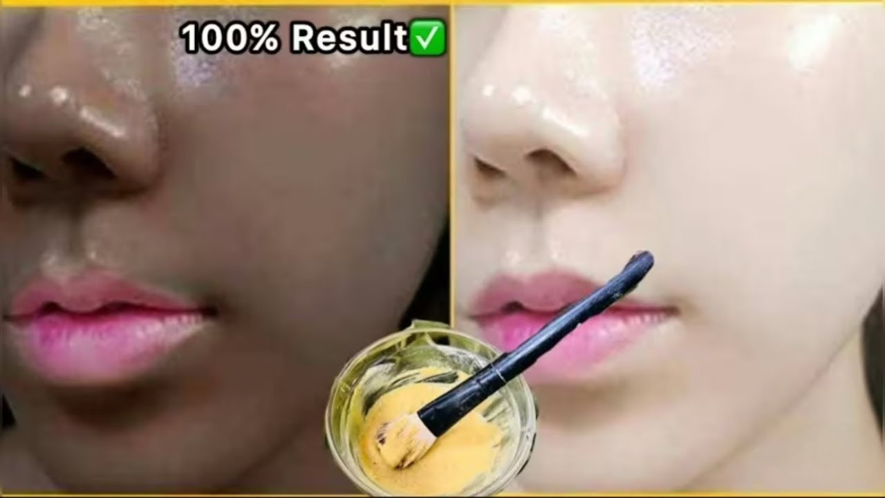 चेहरे का कालापन एक बार लगाने से ग़ायब होज़ायेगा एक बार शैम्पू मैं हल्दी मिला लो बस सब हैरान होजायेगे