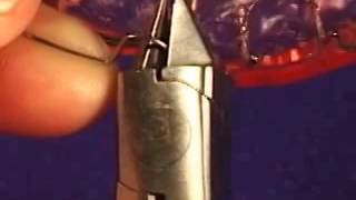Labial Bow Adjustment