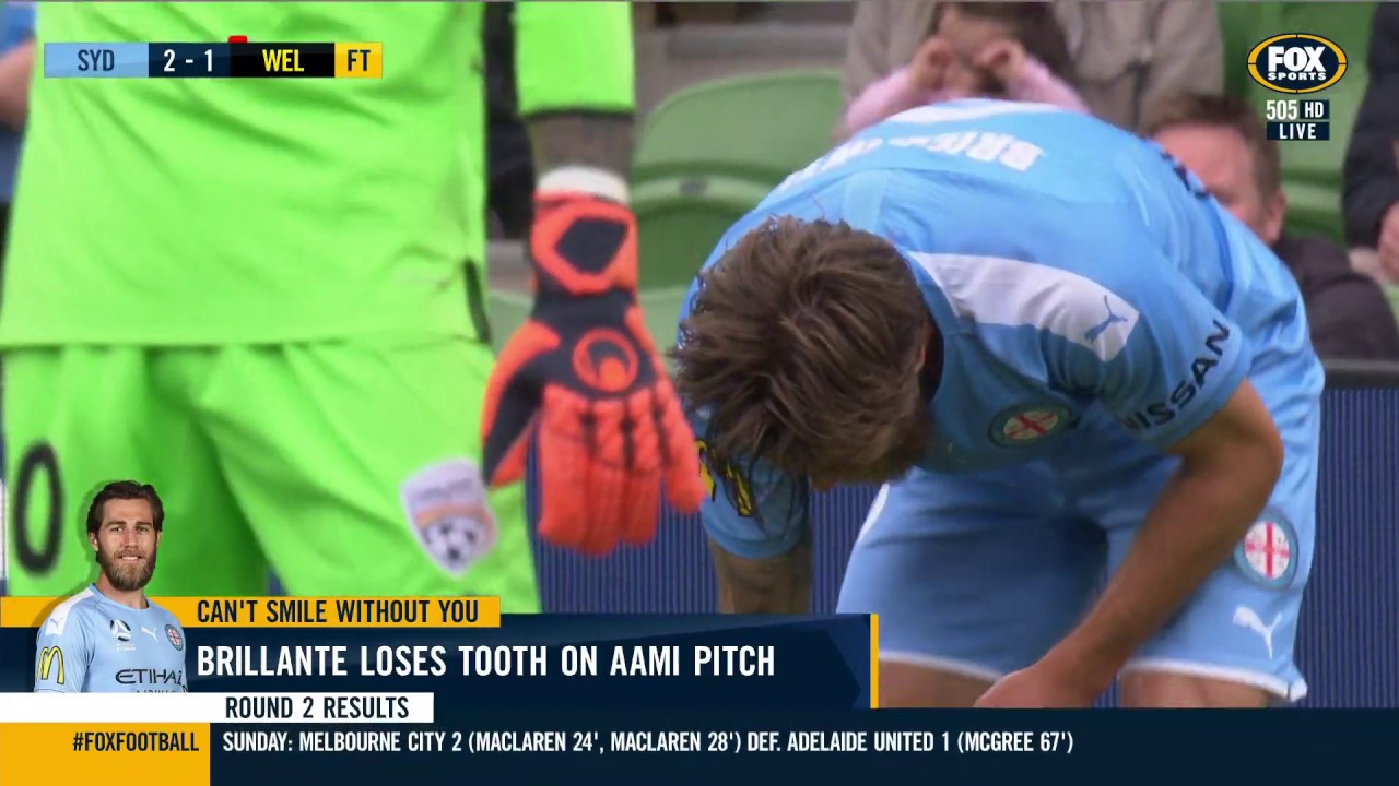 ALeague Player Loses Tooth During Game and Finds it! YouTube