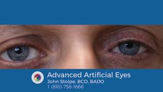 Motion Of A Prosthetic Eye In An Enucleated Eye Socket, Incorporating A Digital Iris