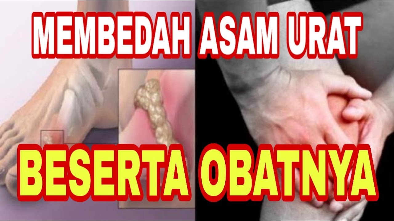Ramuan Asam Urat 085719554305