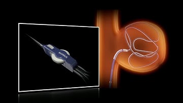SwiftNinja®  Steerable Microcatheter