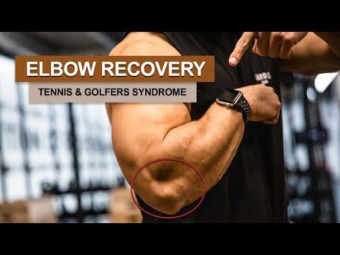 How i healed my Tennis & Golfers Elbow | Stipke 2021