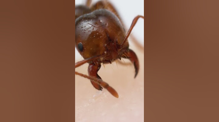 Fire ant bite and sting up-close!