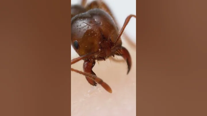 Fire ant bite and sting up-close! - DayDayNews