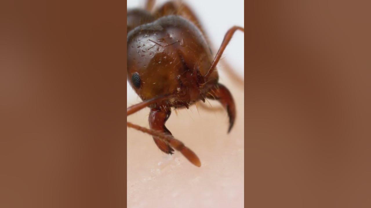 Fire ant bite and sting up-close!