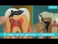 39. Три самых частых диагноза у стоматолога! Натадент