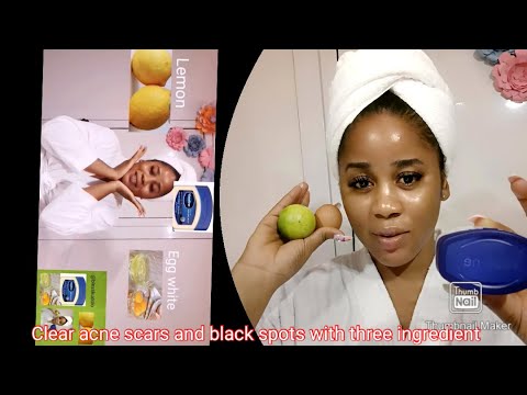 LOOK FOREVER 16 !! Using  Vaseline, Lemon and egg WHITE .  BABY FACE