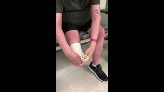 Comment mettre un tubigrip