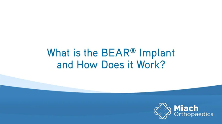 What is the BEAR Implant and How Does it Work? | Q&A | Dr. Sean Keyes | Miach Orthopaedics