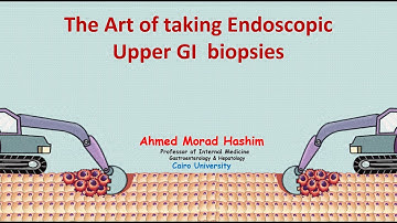 The Art of taking Endoscopic Upper GI biopsies