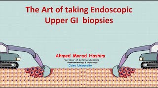 The Art of taking Endoscopic Upper GI biopsies