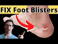 How to Treat a Foot Blister, Toe Blister or Heel Blister [POP IT???]