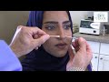 Nonsurgical Liquid Nose Job Demo | Dr. Clevens Performs the Clevens Instant Rhinoplasty - Bayan