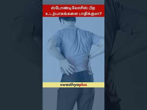 ஸ்போண்டிலோசிஸ் பிற உடற்பாகங்களை பாதிக்குமா? | Does Cervical Spondylosis spread pain? | Dr Praveen R