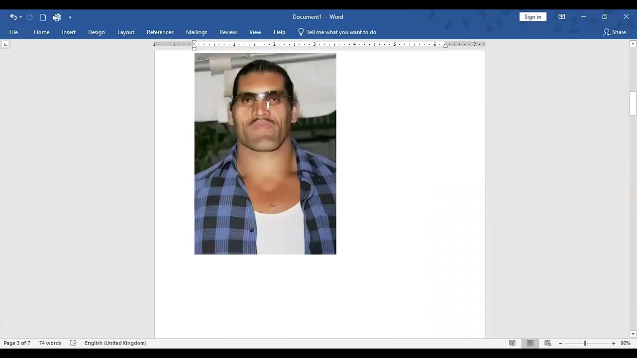 mrcp Station 5 adpkd, acromegaly