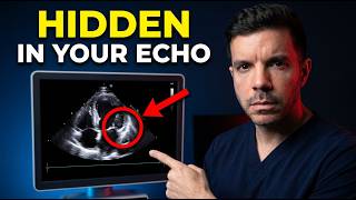 Your Echocardiogram Results: 5 Things Your Doctor Might Not Tell You
