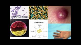 Infecciones con estafilococos