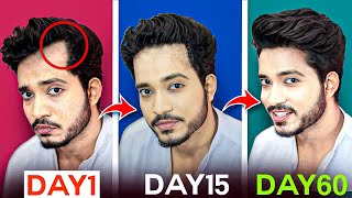 STOP HAIR FALL From Day 1 | Stop Receding Hairline