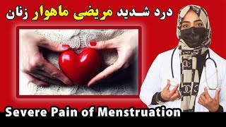 زنان/ دختران در زمان درد شدید مریضی ماهوار چی کنند؟ | What to do for acute pain during menstruation