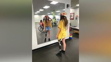 Dallas, AK Amputee in NPS Double Wall Socket