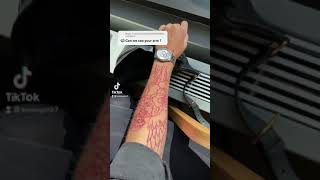 Red Tattoo Removal 1St Session Results