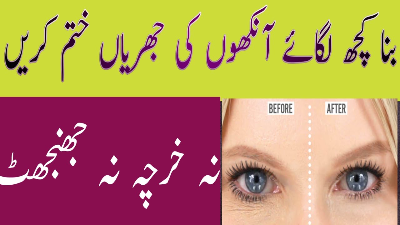 How To Remove Wrinkles Under Eyes|How To Get Rid Of Under Eye Wrinkles|Eye Wrinkle