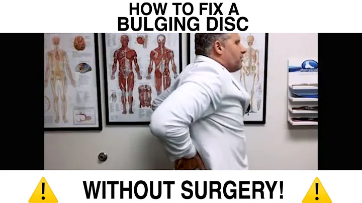 How to Fix a Bulging Disc NO SURGERY!