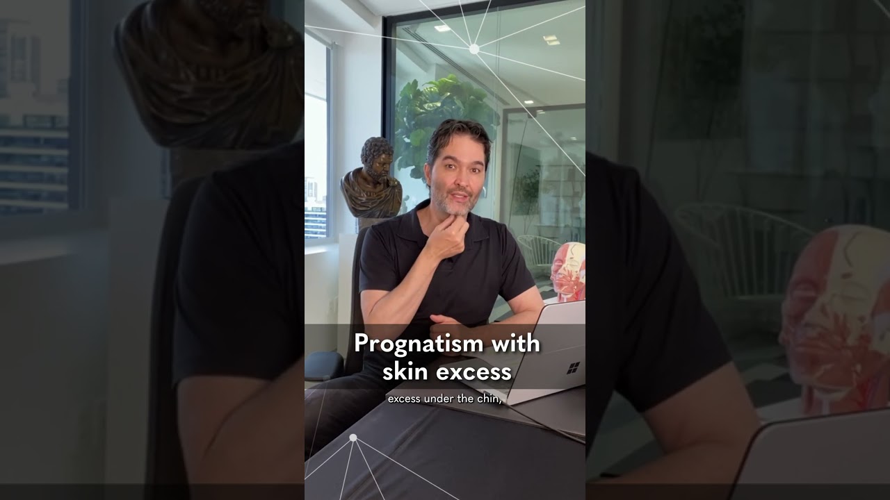 Jw4 & Jw5 with Prognatism? - MD Codes Q&A Session