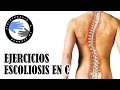 Escoliosis en C, ejercicios correctivos