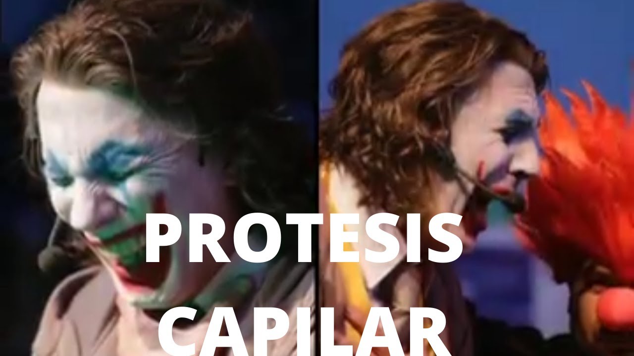 PROTESIS CAPILAR Guason /protesi capelli/ joker hair system /protez saç/hair patch/