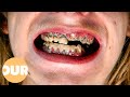 Can My Rotten Teeth Be Saved? | Our Life