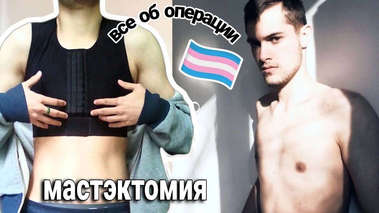 МАСТЭКТОМИЯ У ТРАНСГЕНДЕРНЫХ ПАРНЕЙ | ИСПОРТИЛИ ВСЕ ТЕЛО | ВСЕ ПОДРОБНОСТИ ОБ ОПЕРАЦИИ В МОСКВЕ