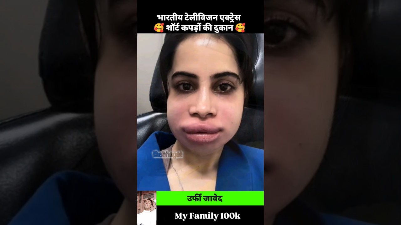 Urfi Javed 💯✅ age transformation journey//
