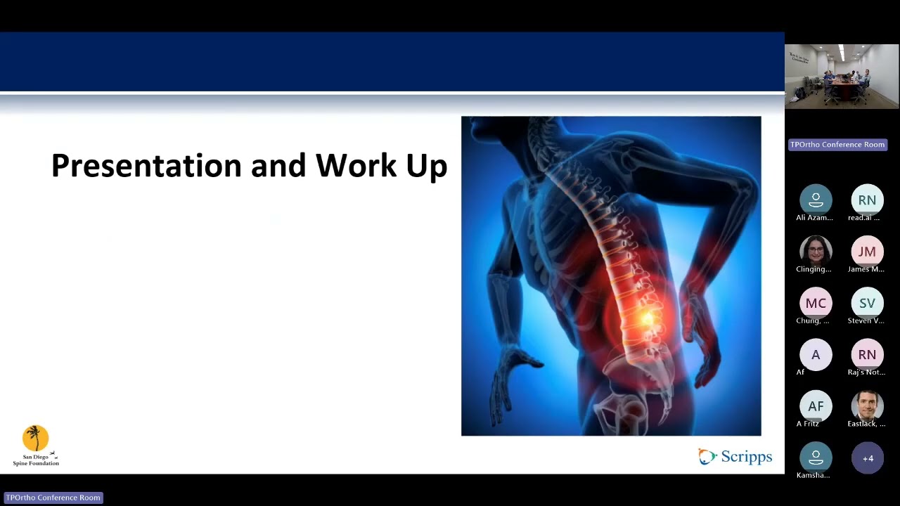Herniated Nucleus Pulposus : Leonie Campbell, MD on August 11, 2025.