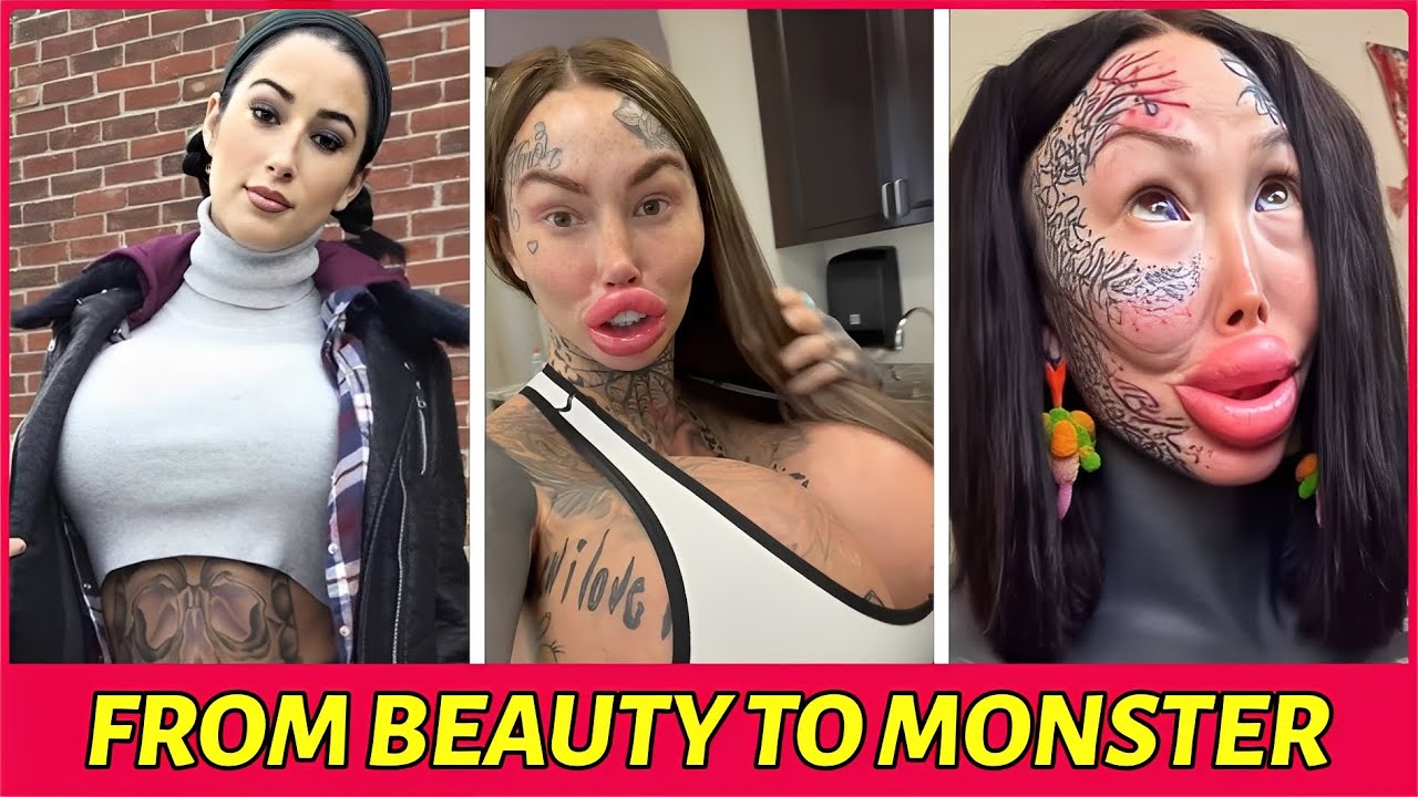 24 Most SHOCKING Plastic Surgery Transformations YouTube