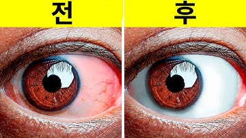 눈의 피로를 덜어주는 10  가지 쉬운 운동