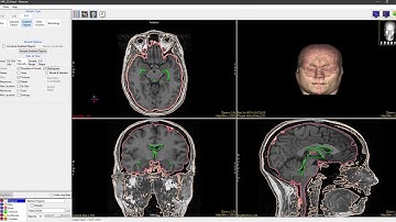 Analyze 14.0 - Measure: Generating Histograms of a Selected Object