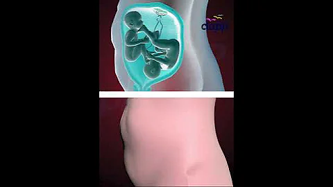 TWINS STRUGGLING TO SURVIVE INSIDE THE WOMB (3D ANIMATION)