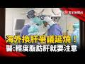 海外換肝爭議延燒！醫示警「輕度脂肪肝」也可能走向移植｜#寰宇新聞 @globalnewstw