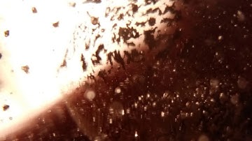 GALLBLADDER CHANNEL/MERIDIAN SYSTEM RESONANCE | MAGNETO - DIELECTRIC ( SCALAR ) FIELDS