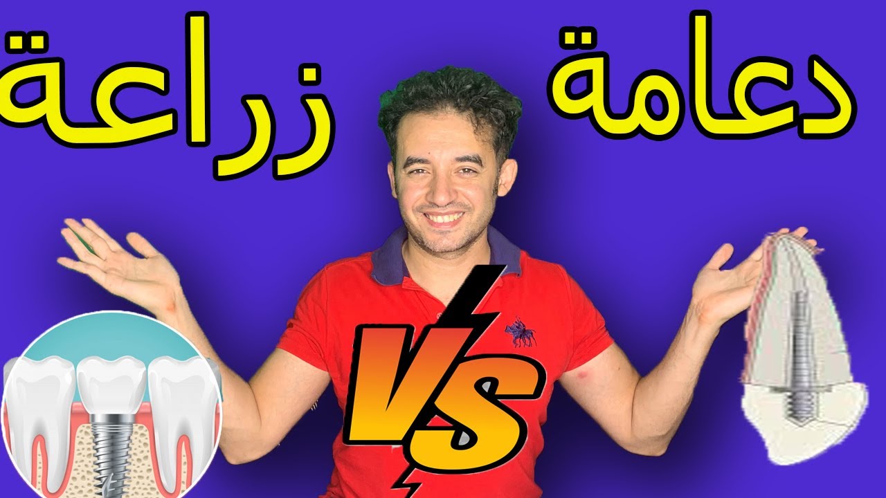 دعامة الضرس والفرق بينها وبين الزراعة