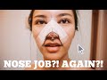 I GOT A NOSE JOB! Rhinoplasty (part 1)