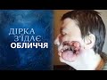 Дыра съедает мое лицо (полный выпуск) | Говорить Україна