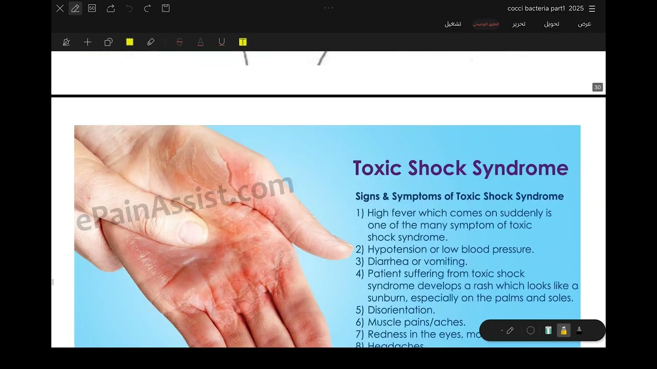 Staphylococcus aureus.... Part 3 last part 