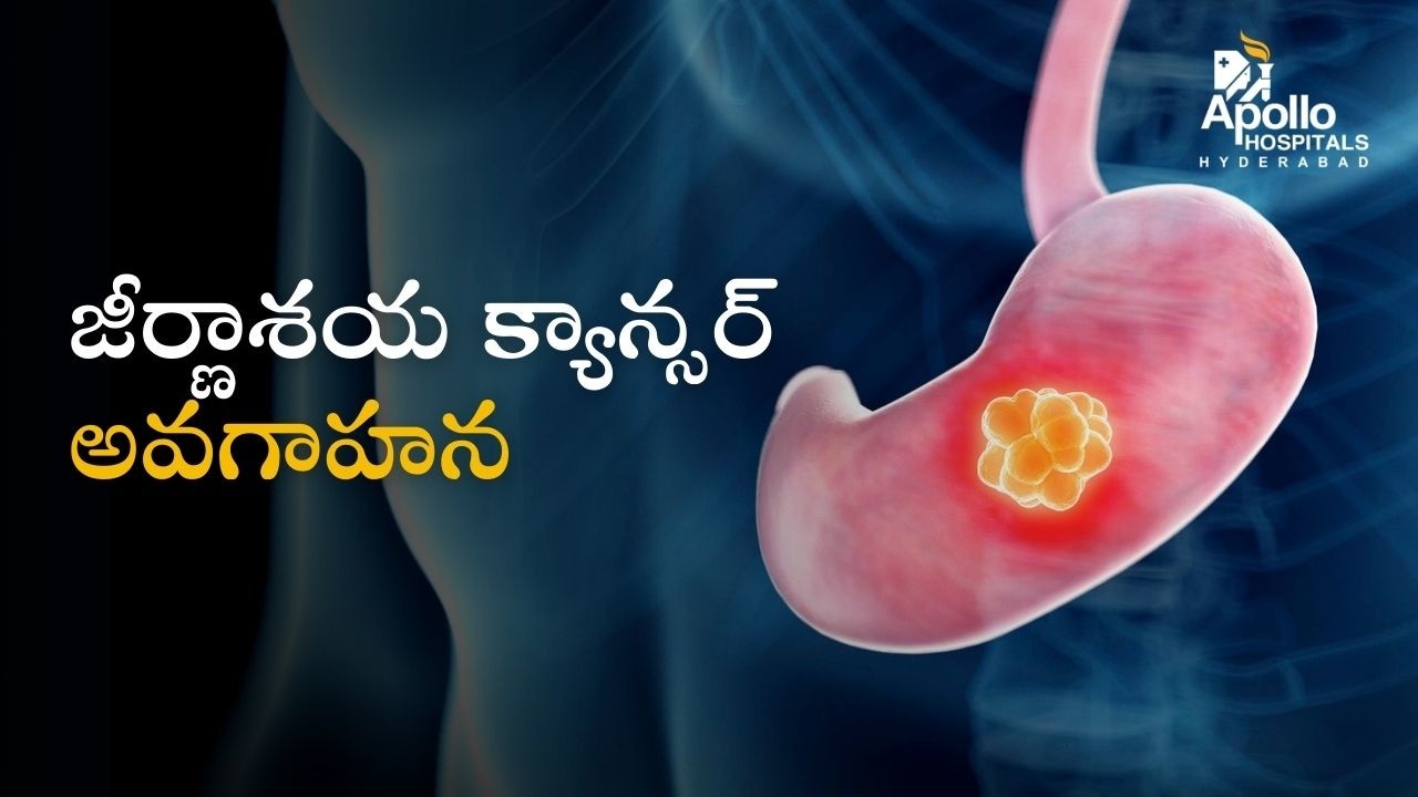 Dr Venkata Sampath V Explains Digestive System Cancers and Early Detection