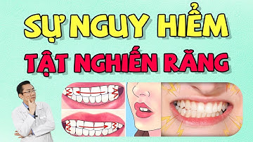 Nghiến Răng | Nguyên Nhân Nghiến Răng | Nghiến Răng Là Gì | Nam Bùi Vinalign
