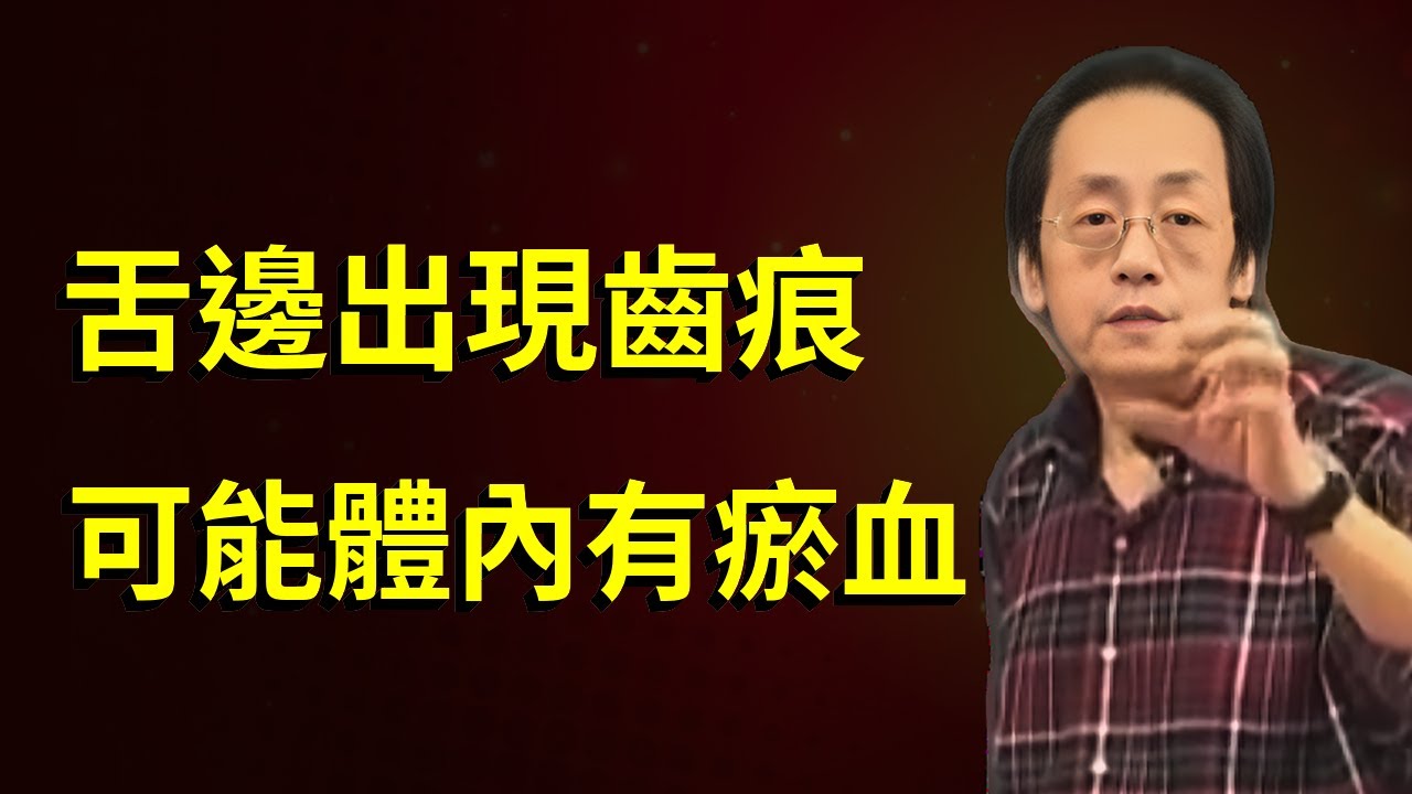 倪海廈：舌頭出現齒痕千萬別不當回事，可能身體正在暗示你體內有瘀血！#傷寒論#瘀血#齒痕#倪海廈#易經