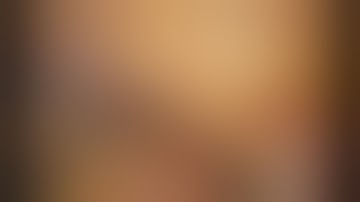 Right partial nephrectomy