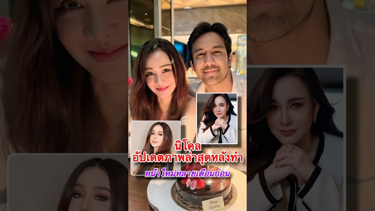 นิโคล อัปเดตภาพล่าสุดหลังทำหน้าใหม่หลายเดือนก่อน ตอนนี้สวยหน้าหวานมาก